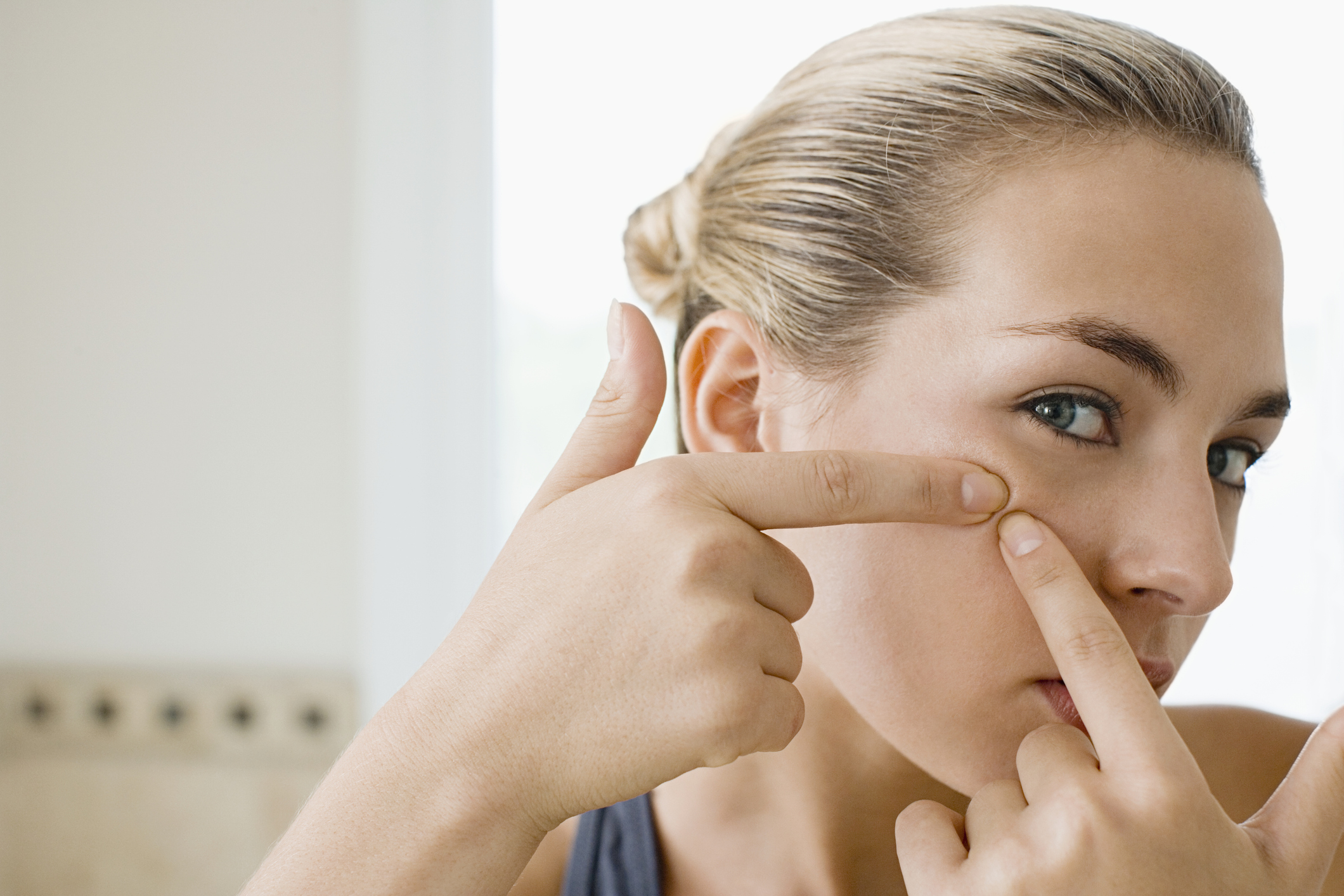 Pimplu The Pimple Index: Колко боли (за егото), когато кожата реши да ни ...