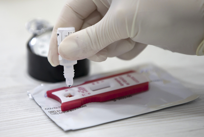 Експертни съвети към Кацаров: Определени тестове за антитела могат да позволят зелен сертификат