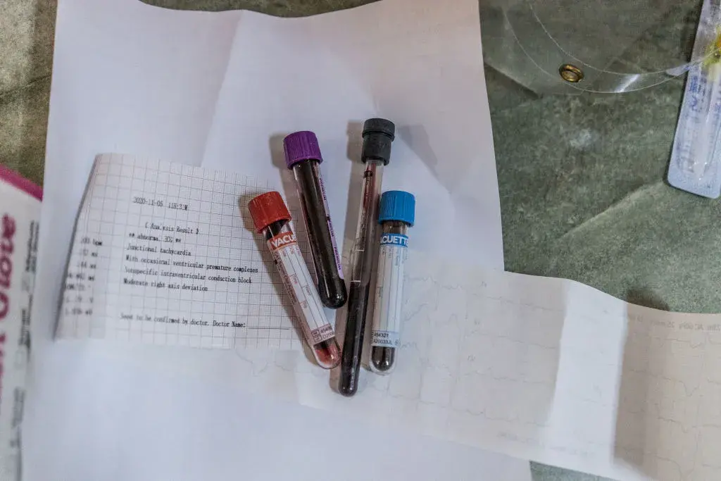Къде в България се правят антигенни тестове, безплатно предоставени от МЗ (карта)