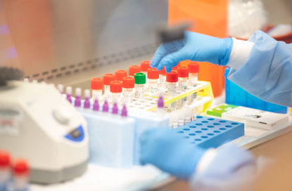 Правителството одобри покупка на 30 000 PCR теста от Южна Корея