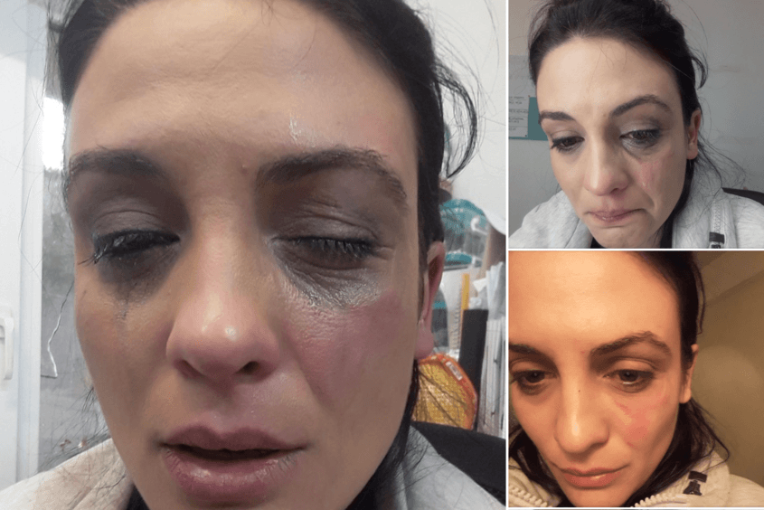  Прокуратурата се самосезира за насилието от колега над актрисата Диана Димитрова