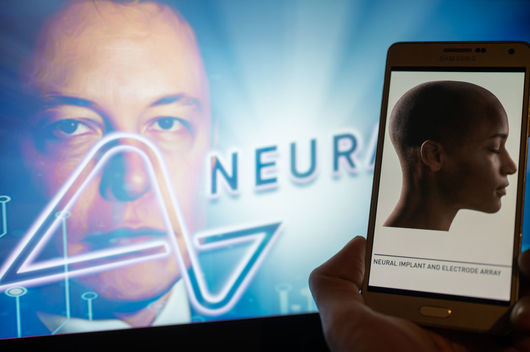 "Като епизод от Black Mirror": Какво знаем за мозъчните импланти на Neuralink?