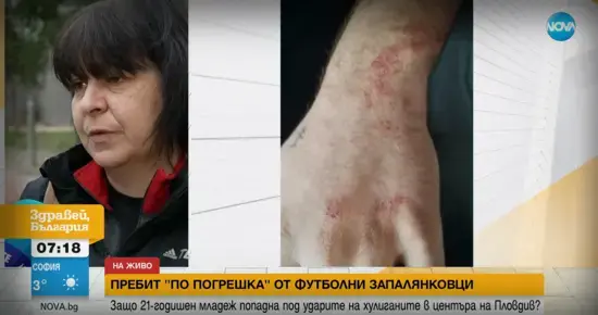 21-годишен мъж е пребит от маскирани нападатели с бухалки в Пловдив