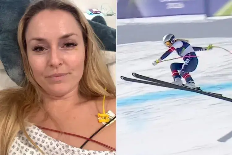 Линдзи Вон се нуждае от поне пет операции след падането на Олимпийските игри 