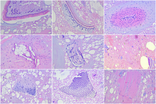 Под микроскопа: Какво съдържат кренвиршите от българския пазар